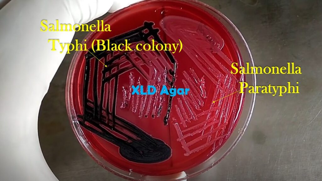 Salmonella Typhi and Paratyphi Colony Morphology  on XLD agar