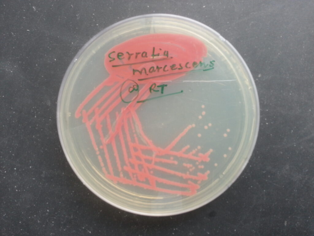 Serratia marcescens pigment expression at room temperature demonstration