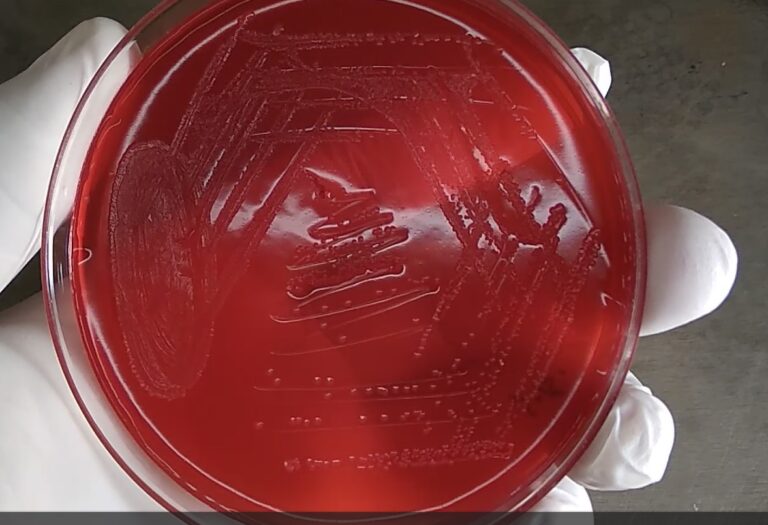 Shigella Flexneri Introduction Identification Features Keynotes A
