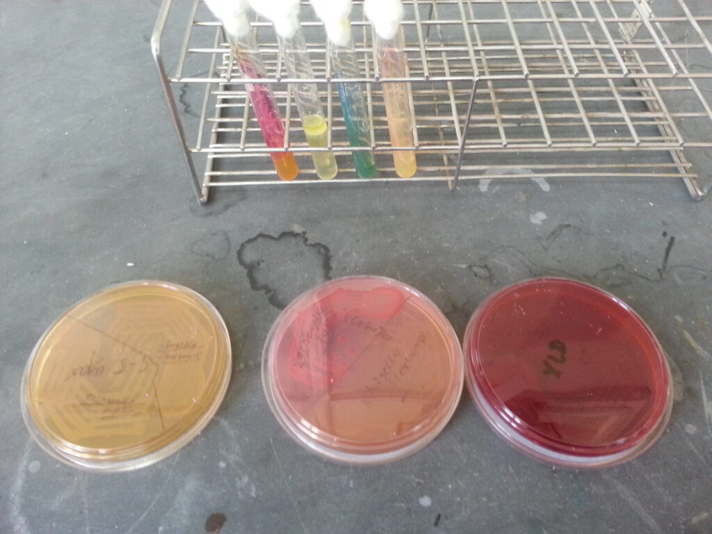 Shigella flexneri colony morphology on Salmonella-Shigella agar, XLD agar, and biochemical reactions in TSI, SIM, citrate and urea agar demonstration