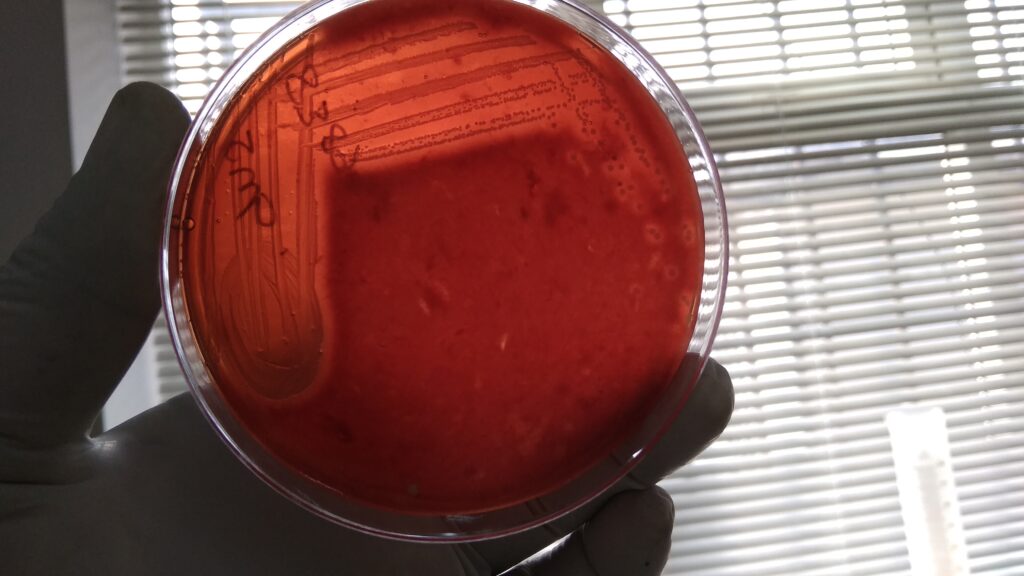 Staphylococcus aureus beta-haemolytic colonies on blood agar