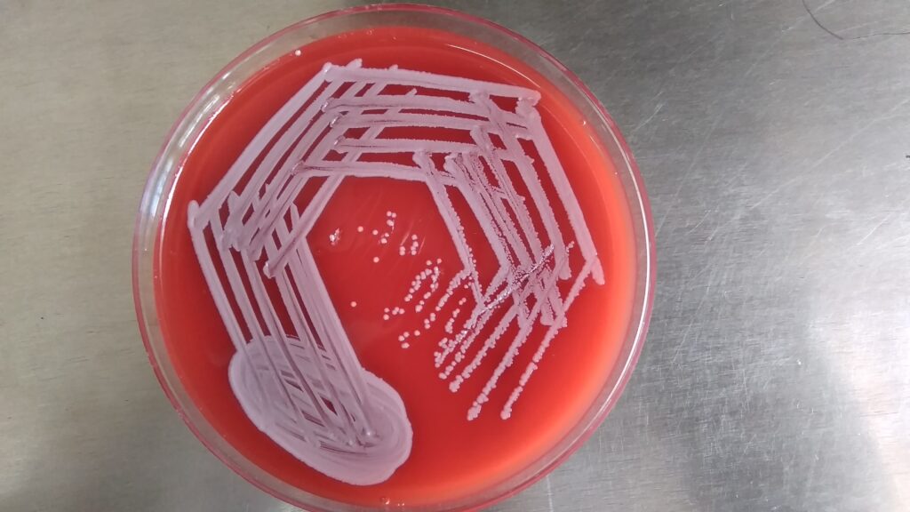 Staphylococcus aureus growth on blood agar