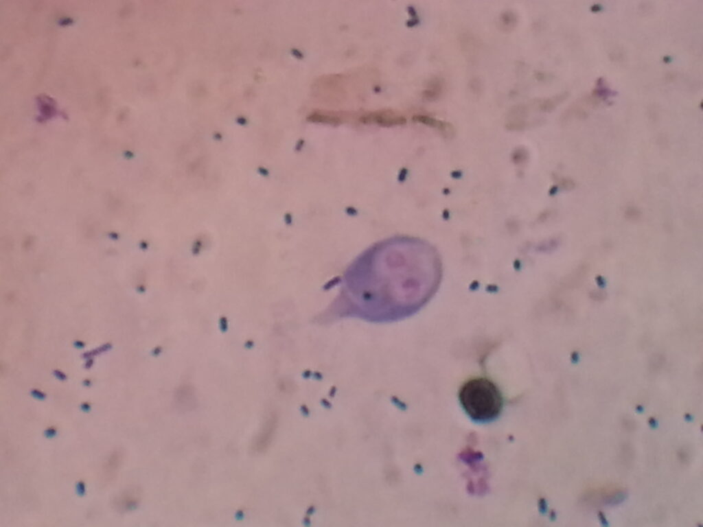 Trophozoite of Giardia lamblia in Trichome stained smear of feces microscopy