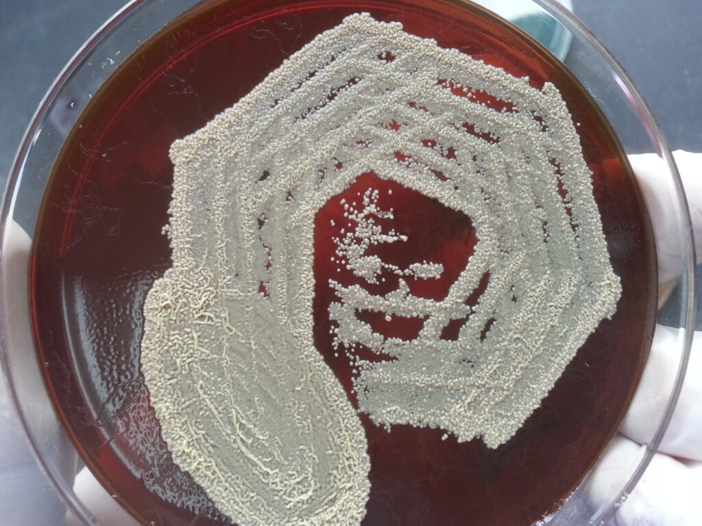 Turicella colony morphology on blood agar