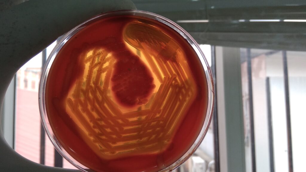 Vibrio Cholerae haemodigestion on blood agar after 72 hours of incubation
