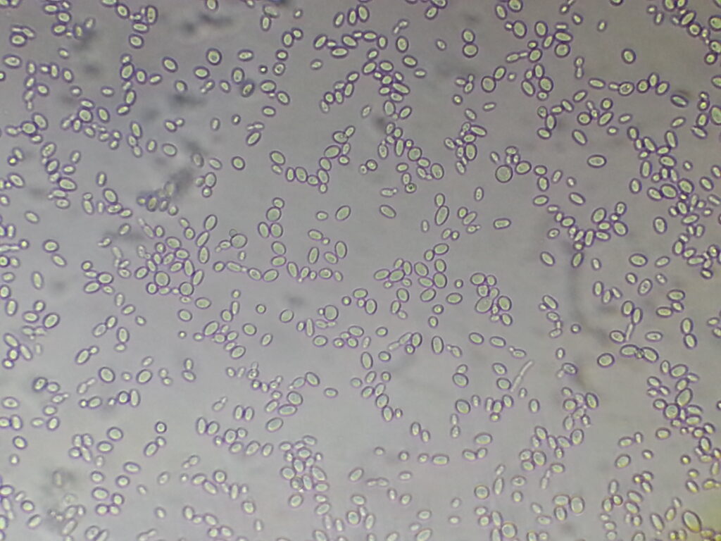 Yeast cells and budding in wet mount of culture microscopy