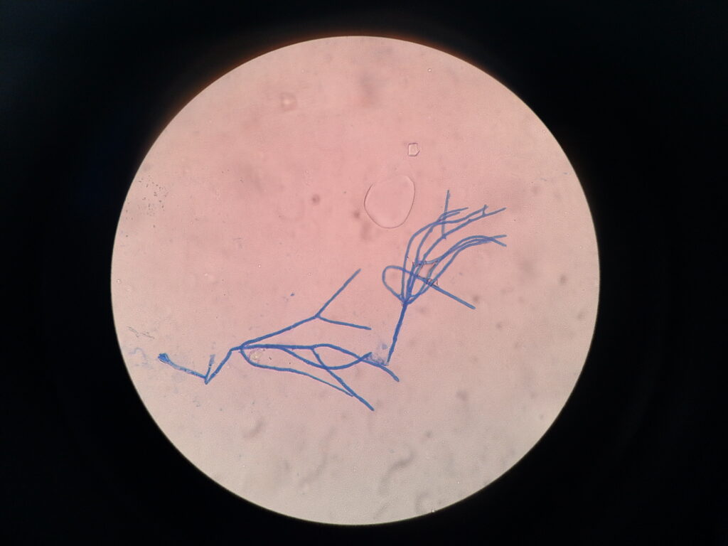 Young fungal hyphae and mycelium from young growth which further needs to be incubated for fungal identification