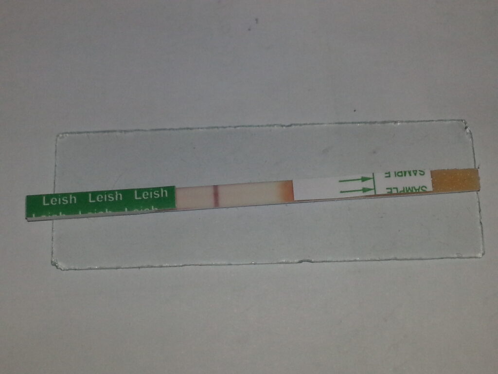 rK39 immunochromatographic strip test showing negative  result