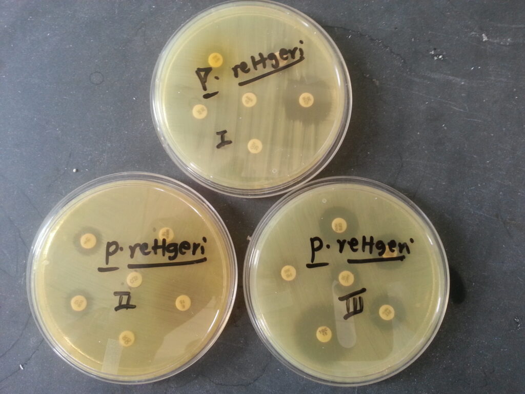 Antimicrobial susceptibility testing (AST) pattern of Providencia rettgeri
