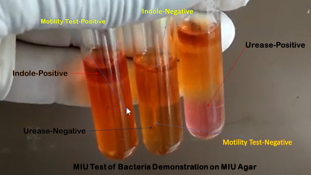 Motile and non-motile bacteria, indole positive and negative, urease positive and negative organisms on MIU agar demonstration