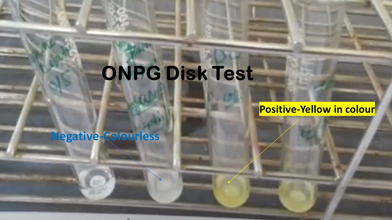 ONPG Test Negative (left) and Positive Bacteria (right)