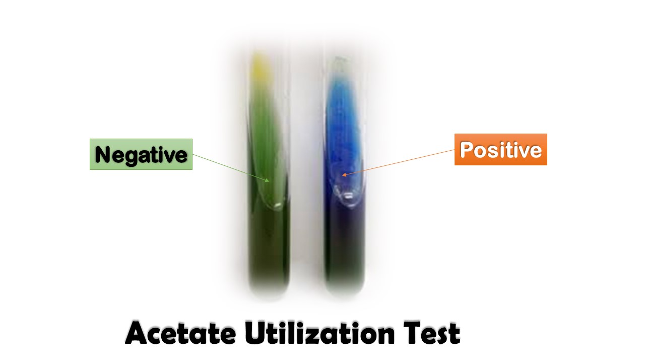 Acetate Utilization Test-Negative (left) and Positive (right side)