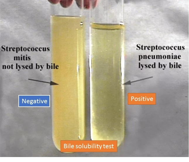 Bile Solubility Test- Positive and Negative
