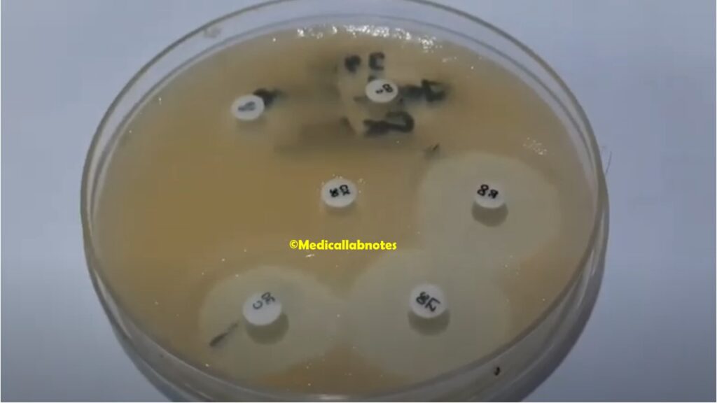 Cefoxitin Resistant Staphylococcus aureus