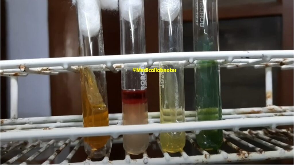 E. coli  biochemical tests in TSI, SIM, Urea, and Citrate agar
