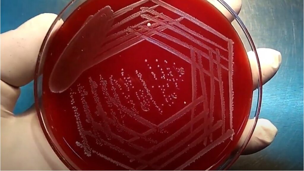 Enterococcus colony morphology on 5% sheep blood agar