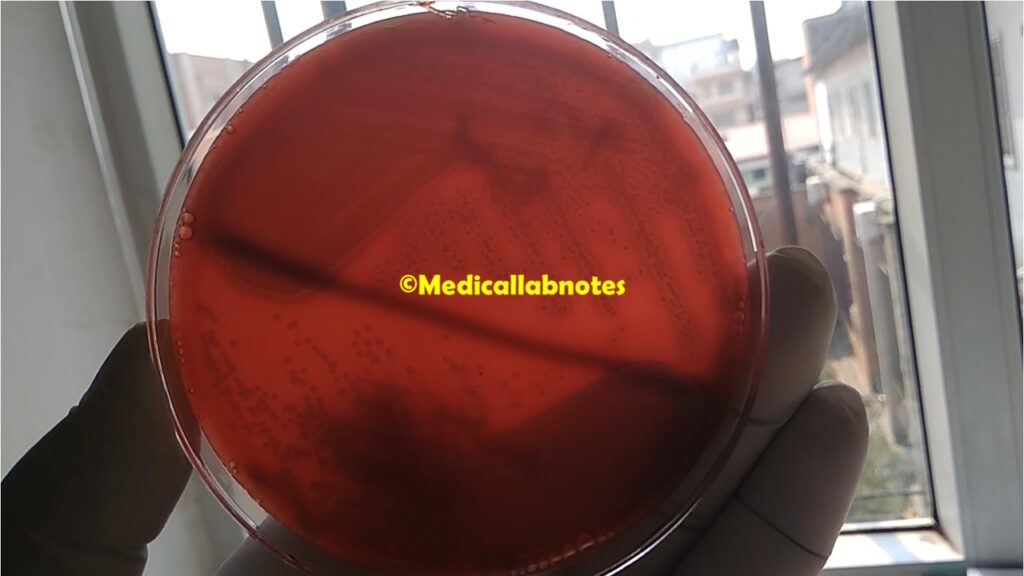 Heavy growth of Staphylococcus aureus on blood agar of pus culture showing beta-haemolytic colonies