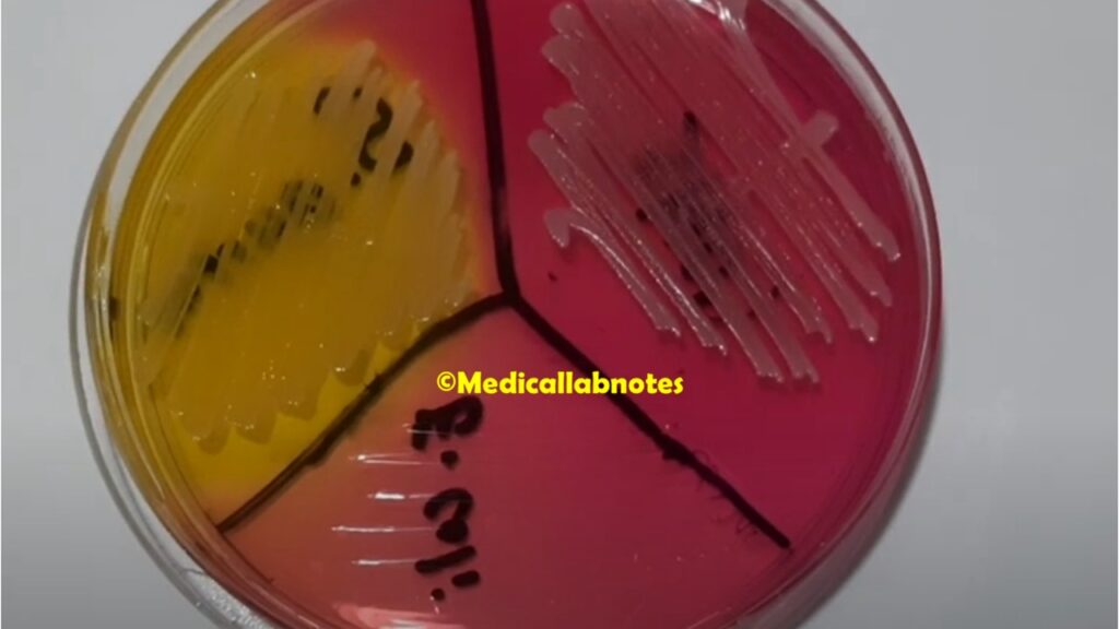 Mannitol Salt Agar ( MSA) with growth of Staphylococcus aureus, CoNS and  but lacking growth of E. coli