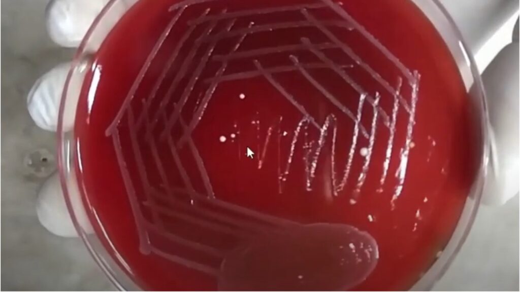Neisseria gonorrhoeae growth on blood agar