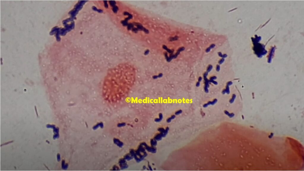 Non-Ideal Smear of Sputum  at a Magnification of 2000X Showing Epithelial Cells and Normal Flora