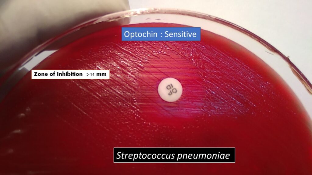 Optochin Susceptibility Test