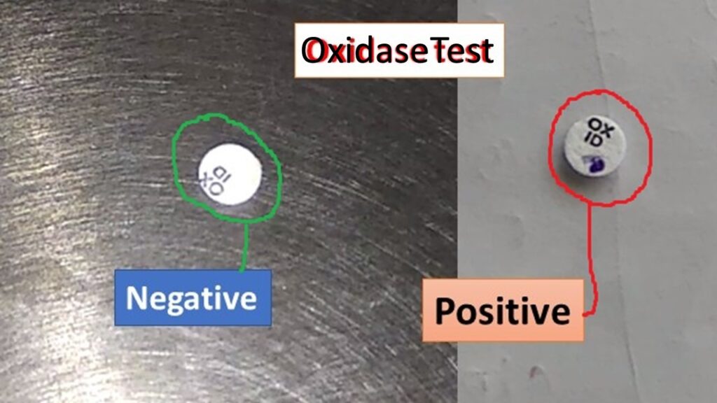 Oxidase Test-Positive and Negative Bacteria