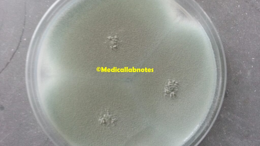 Penicillium colony characteristics on Potato Dextrose Agar (PDA)