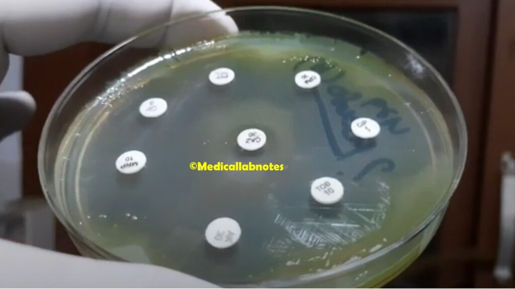 Pseudomonas aeruginosa Antimicrobial sensitivity testing Pattern
