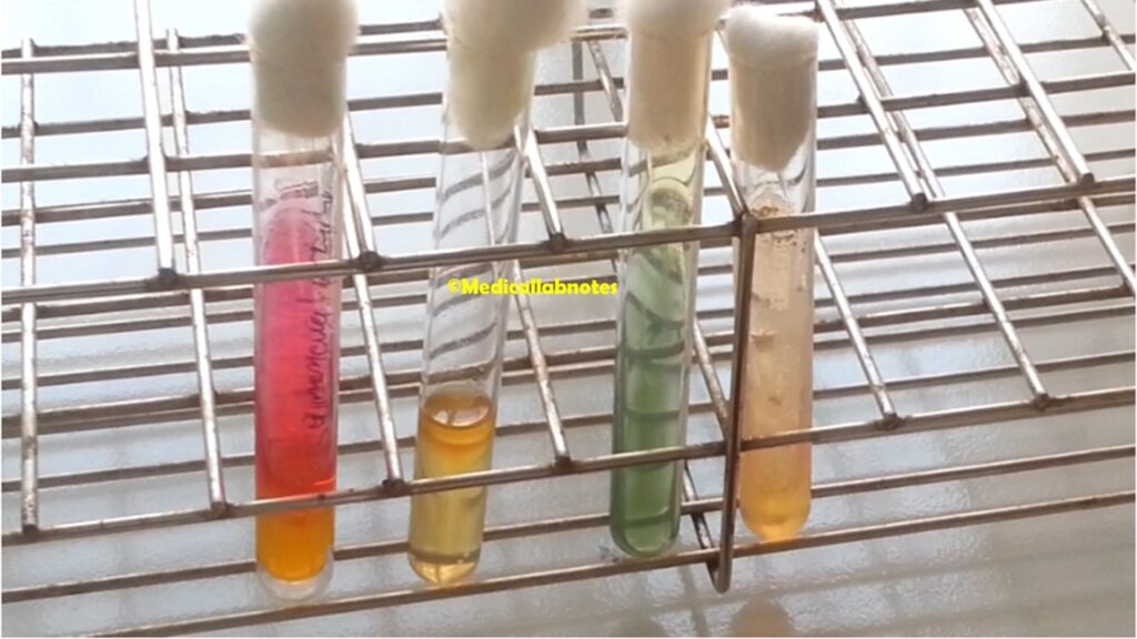 Salmonella Paratyphi biochemical tests in TSI, SIM, Urea, and Citrate agar