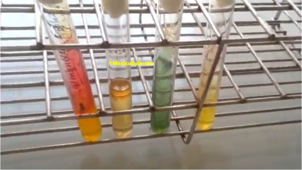 Salmonella Typhi biochemical tests in TSI, SIM, Urea, and Citrate agar