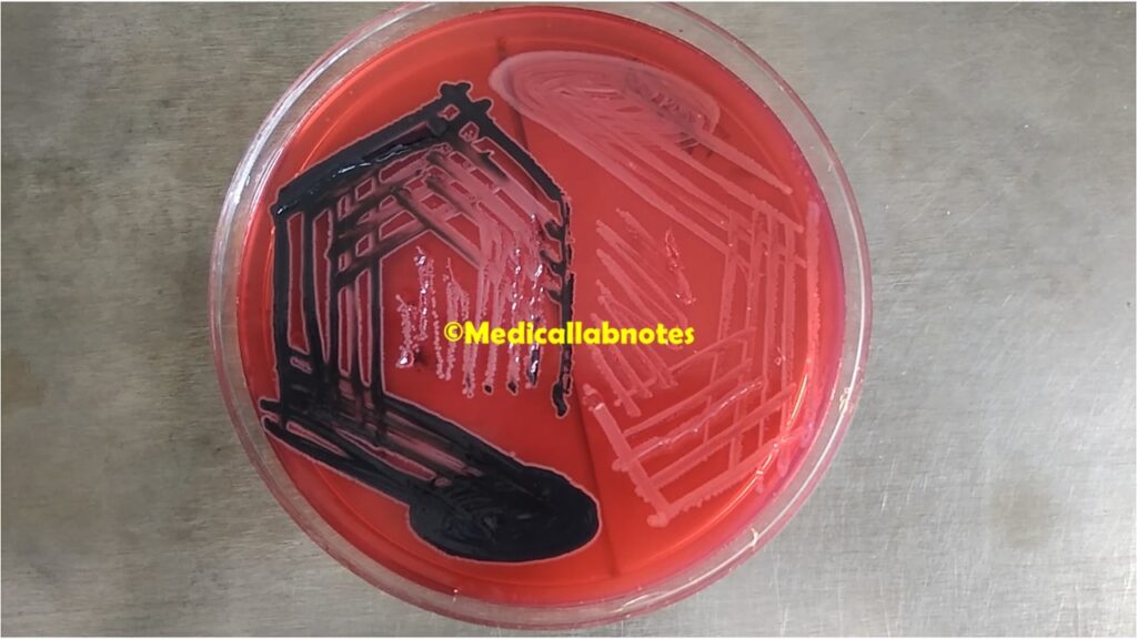 Salmonella Typhi (black colony) and Shigella growth on  xylose lysine deoxycholate (XLD) agar