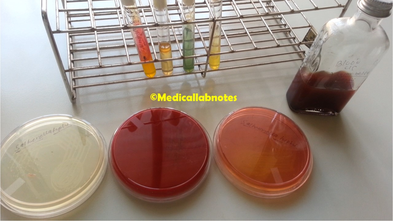 Salmonella Typhi isolated from blood culture-Growth on Nutrient agar, blood agar and MacConkey medium, Biochemical reactions in TSI, SIM,Citrate and Urea agar, and growth on broth medium (blood culture bottle)-demonstration