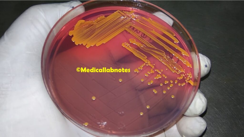 Staphylococcus aureus on CLED agar
