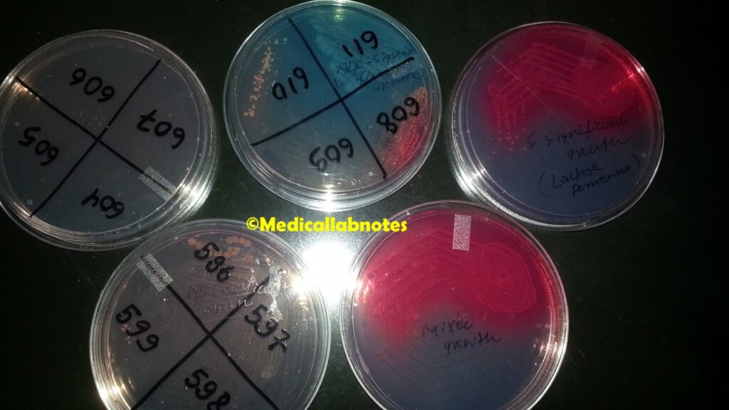 Lactose fermenter bacteria, non-lactose fermenter bacteria, Mixed growth of bacteria, no growth of microbes, significant growth of uropathogens, non-significant growth of uropathogens, mucoid growth of bacteria on CLED agar demonstration