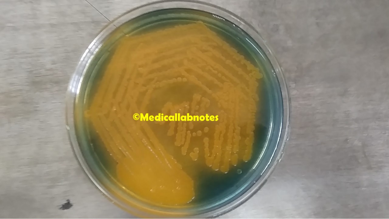Vibrio cholerae colony morphology on TCBS agar