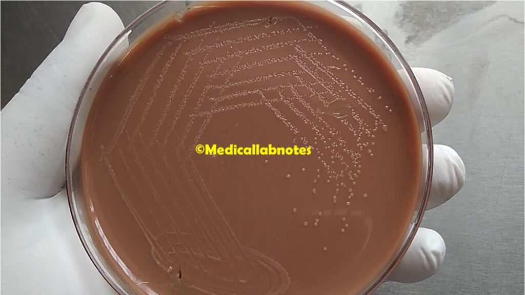 Campylobacter fetus growth on Chocolate agar