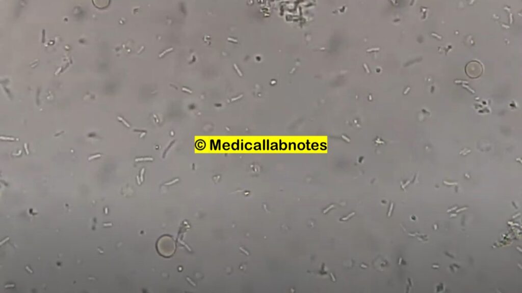 E. hermanii in BD™ Tryptic Soy Broth (TSB) wet mount microscopy
