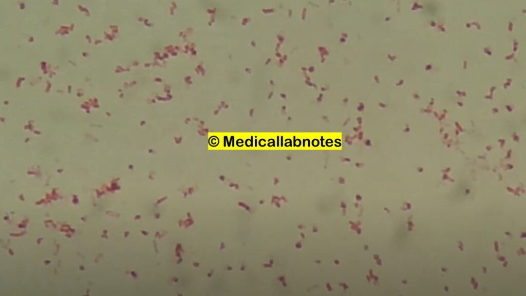 Gram Negative Rods of E. hermannii in Gram Staining of Culture