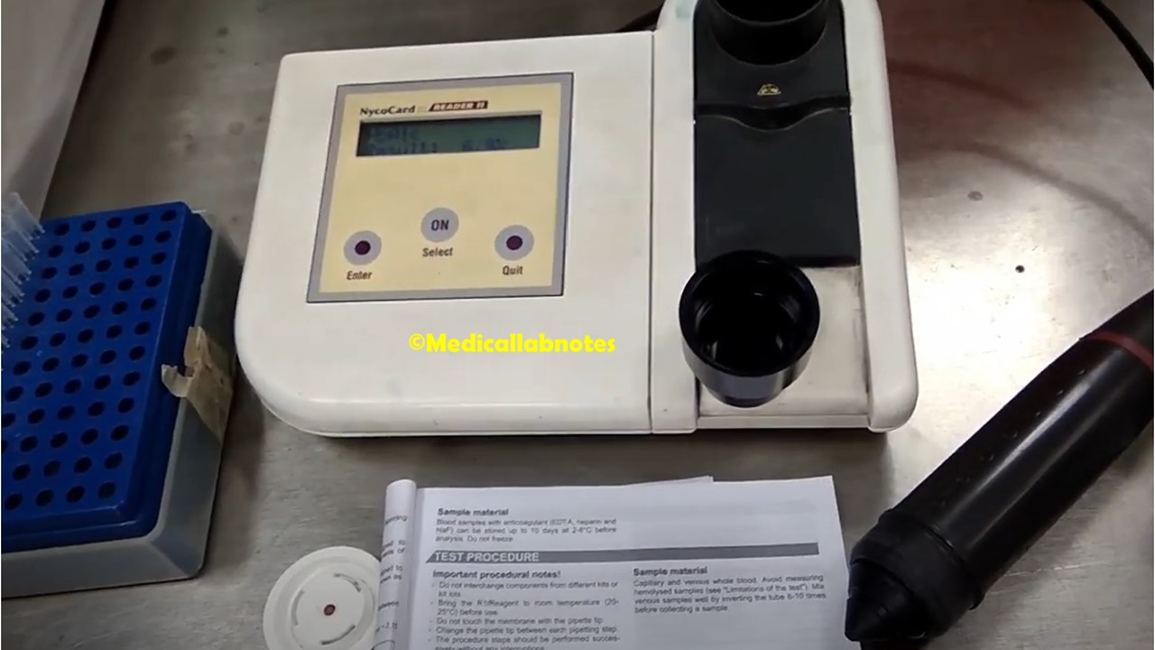 HbA1C blood test using Nycocard Reader