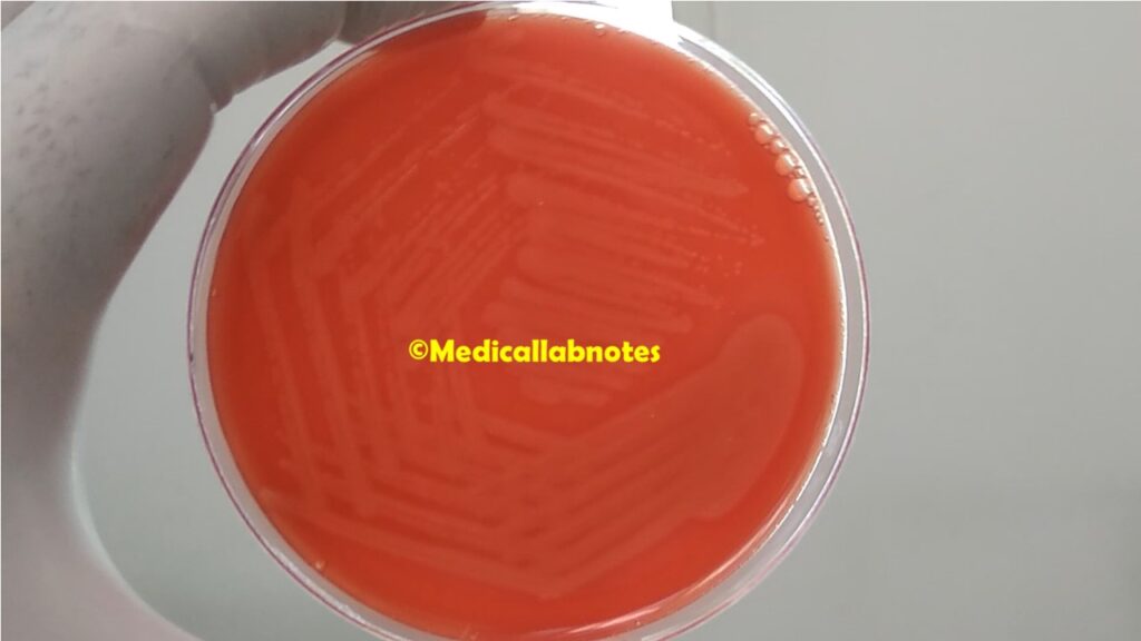Listeria monocytogenes beta-haemolytic colony on Blood agar