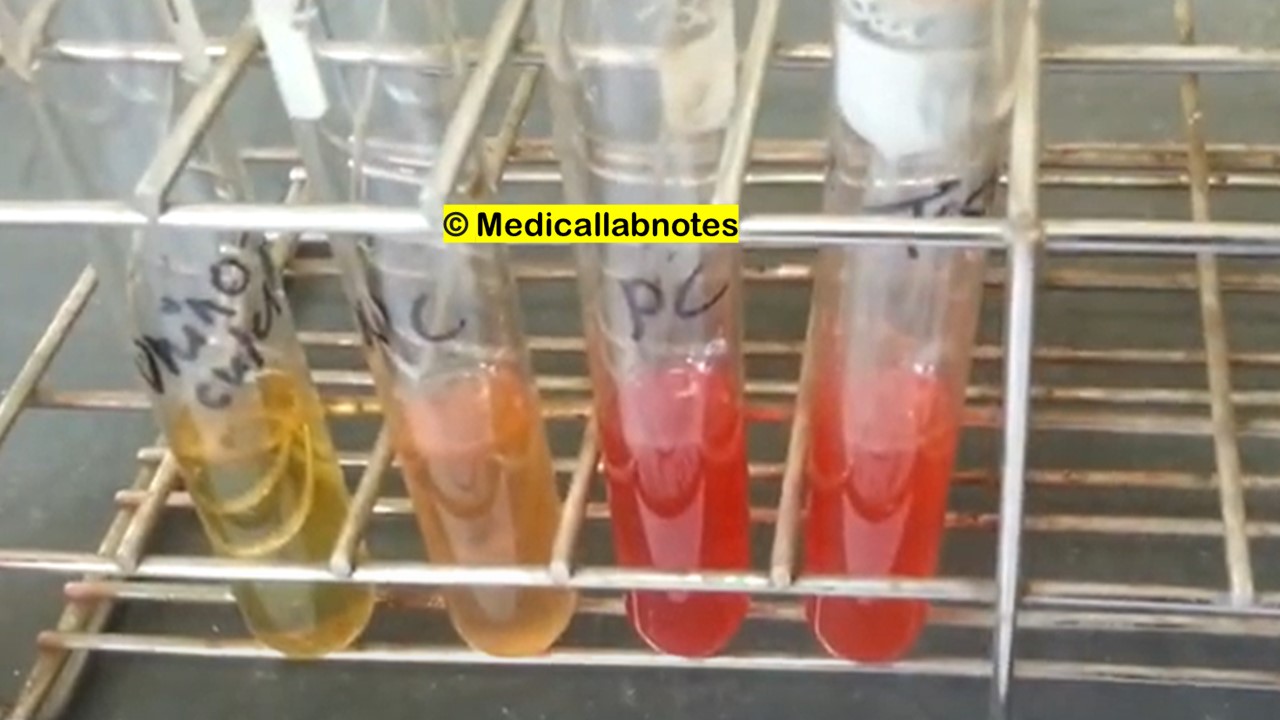 Methyl Red Test-Positive and Negative Test Results