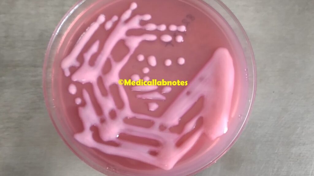 Mucoid Lactose Fermenting Colony  of Klebsiella Pneumoniae on MacConkey agar