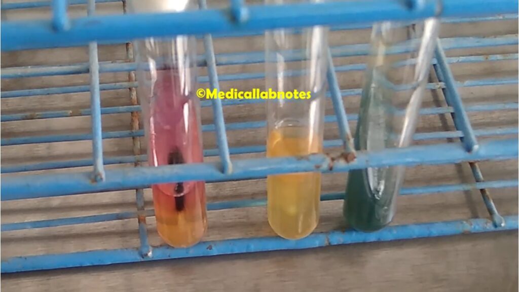 Salmonella Typhi Biochemical Reactions in TSI, MIU and Citrate agar