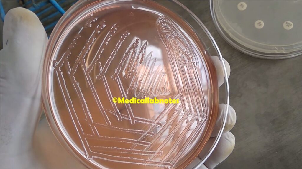 Salmonella Typhi colony morphology on MacConkey agar
