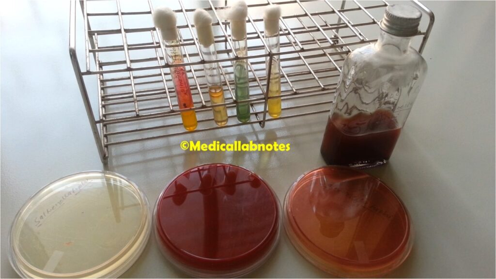 Salmonella Typhi growth on liquid medium (BHI broth), solid media (nutrient agar, MacConkey medium and blood agar), and biochemical reactions in TSI, SIM, Citrate, and Urea agar demonstration