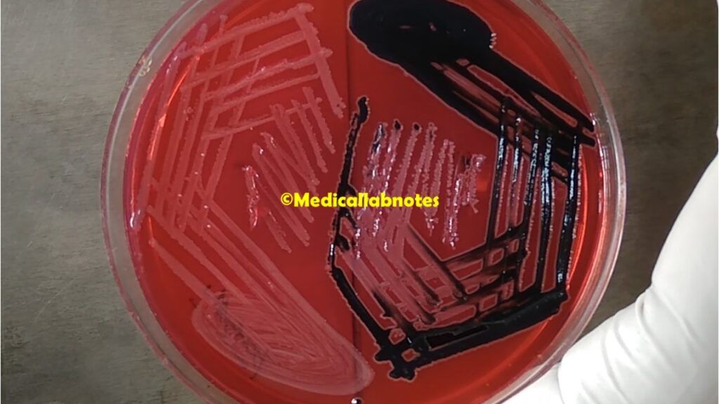 Salmonella and Shigella growth on XLD agar