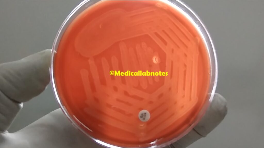 Streptococcus agalactiae showing beta-hemolytic colonies through  bright transmitted light and bacitracin (0.04U) resistant
