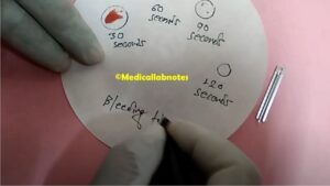 Coagulation Test: Introduction, List of Tests, Description