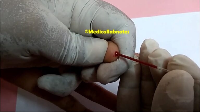Coagulation Test: Introduction, List of Tests, Description