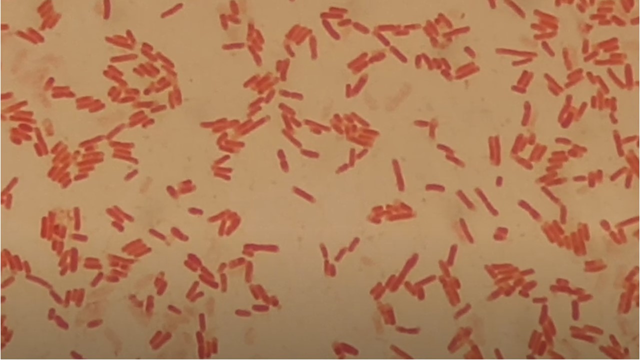 Escherichia coli in Gram Staining of Culture Microscopy at a Magnification of 4000X
